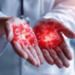 Ce symptôme sur vos mains ou pieds pourrait révéler une IST : ce qu'il faut savoir